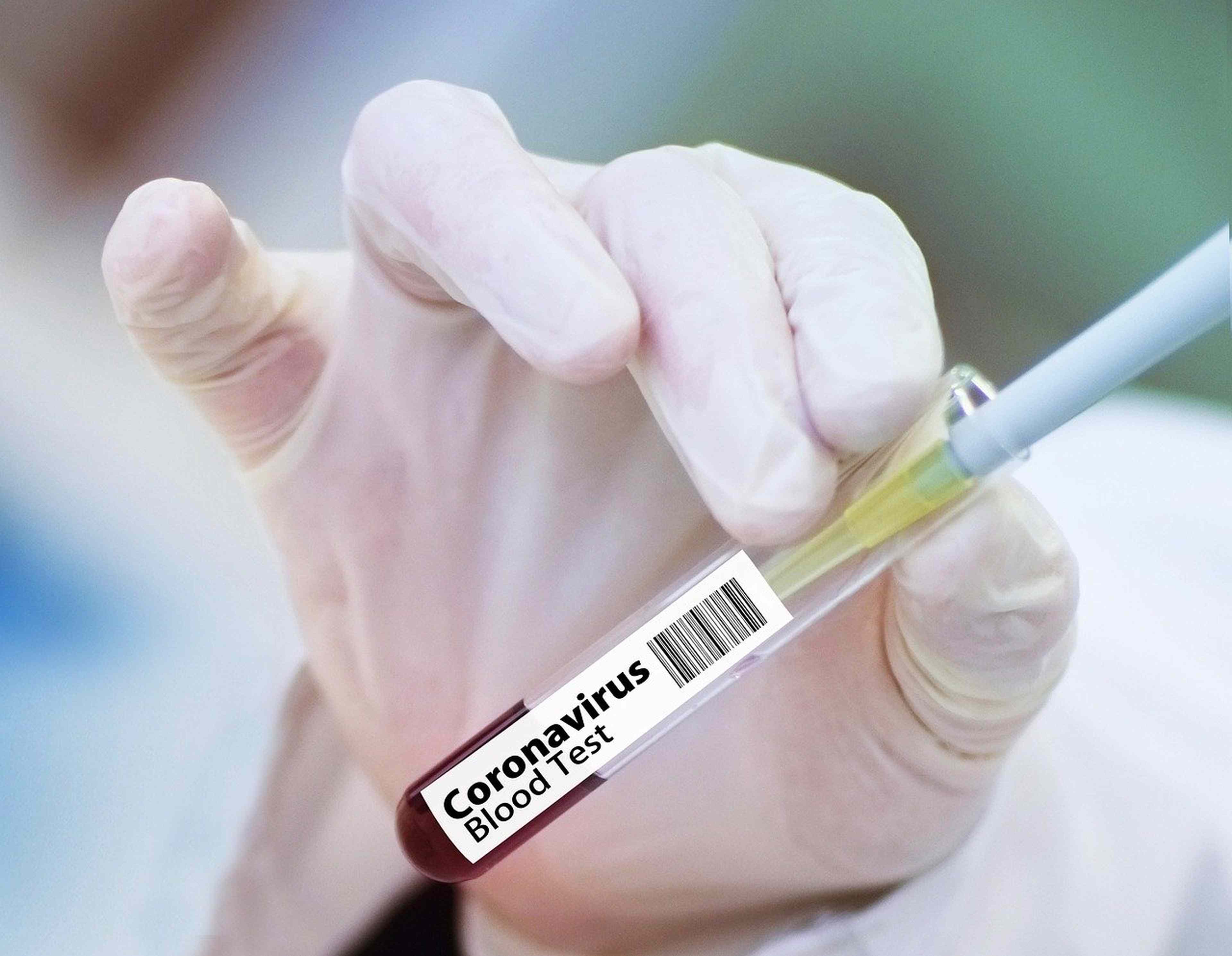 /2020/09/vaccine-4946480_1280
